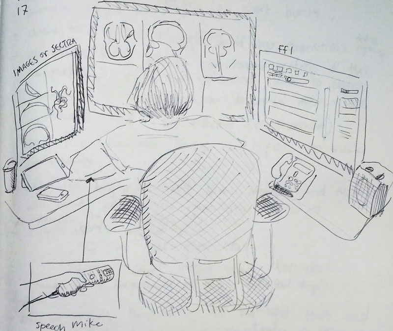 a drawing of a radiologist reading brain scans.